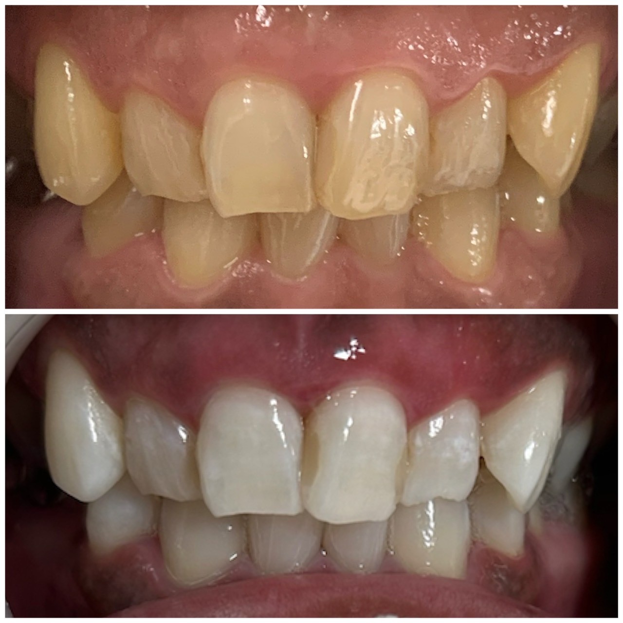 ライトビューティー 本八幡店｜輝く白い歯に